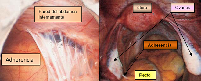 Centro Integral de Reproducción Humana - Laparoscopía